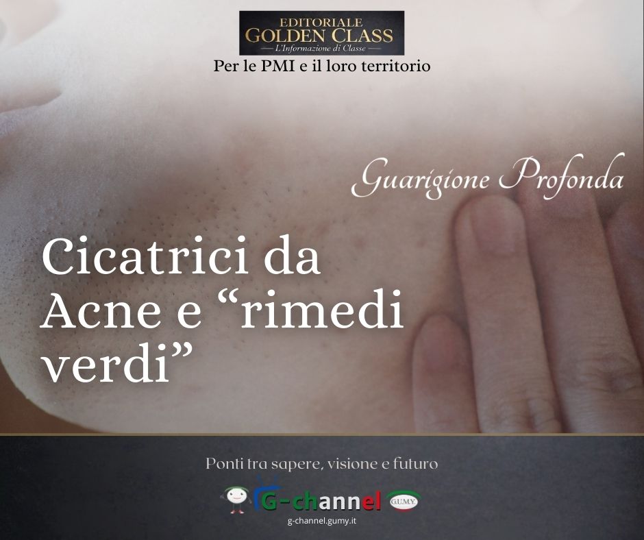 Cicatrici da Acne e “rimedi verdi”